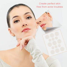 Load image into Gallery viewer, Pimples Sticker M Nexcare Waterproof &amp; Bacteria Free Patches