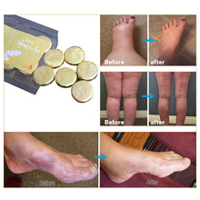 Load image into Gallery viewer, Anti-Swelling &amp; Fungal Foot SPA